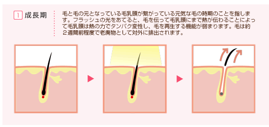 毛と毛の元となっている毛乳頭が繋がっている元気な毛の時期のことを指します。フラッシュの光をあてると、毛を伝って毛乳頭にまで熱が伝わることによって毛乳頭は熱の力で凝固し、毛を再生する機能を停止します。毛は約２週間前程度で老廃物として対外に排出されます。