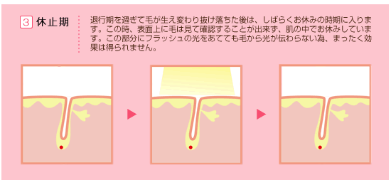 退行期を過ぎて毛が生え変わり抜け落ちた後は、しばらくお休みの時期に入ります。この時、表面上に毛は見て確認することが出来ず、肌の中でお休みしています。この部分にフラッシュの光をあてても毛から光が伝わらない為、まったく効果は得られません。