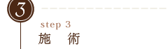 ステップ3｜施術