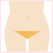 脱毛メニュー Vライン